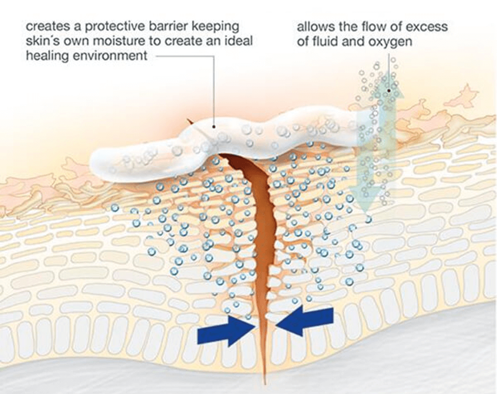 how aquaphor ointment works on skin